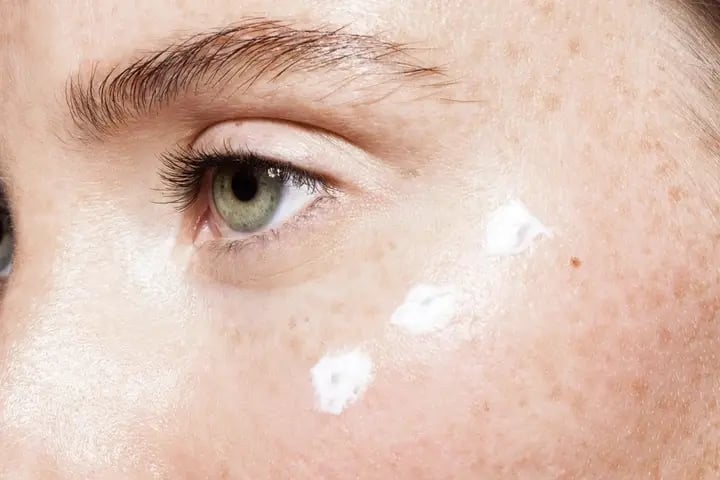 ¿Cuáles son las causas de las ojeras y cómo eliminarlas?