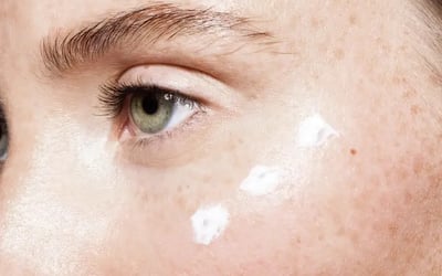 ¿Cuáles son las causas de las ojeras y cómo eliminarlas?